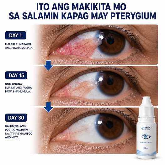 Lumyra Pterygium, Cataract, Glaucoma Remover Dropper